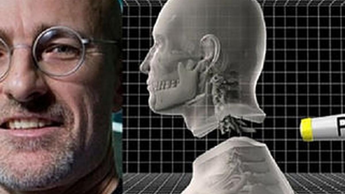 Frankenstein 2.0, trapianto di testa ora è realtà